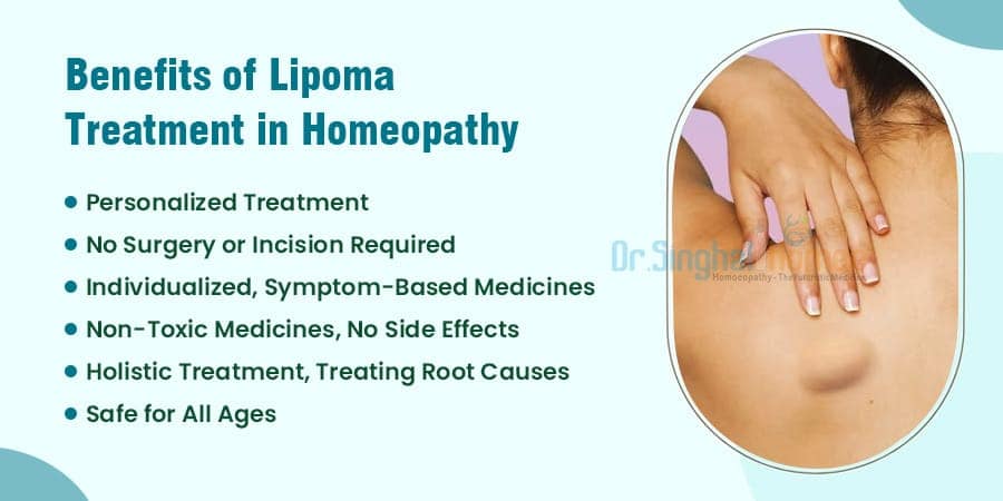 Benifits of Lipoma Treatment in Homeopathy